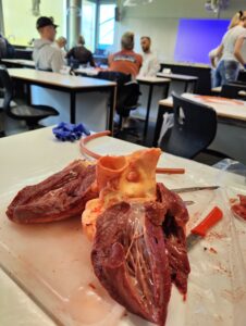 Anatomiundervisning for sykepleierstudentene. Hjerte i forgrunnen og studenter i bakgrunnen. 